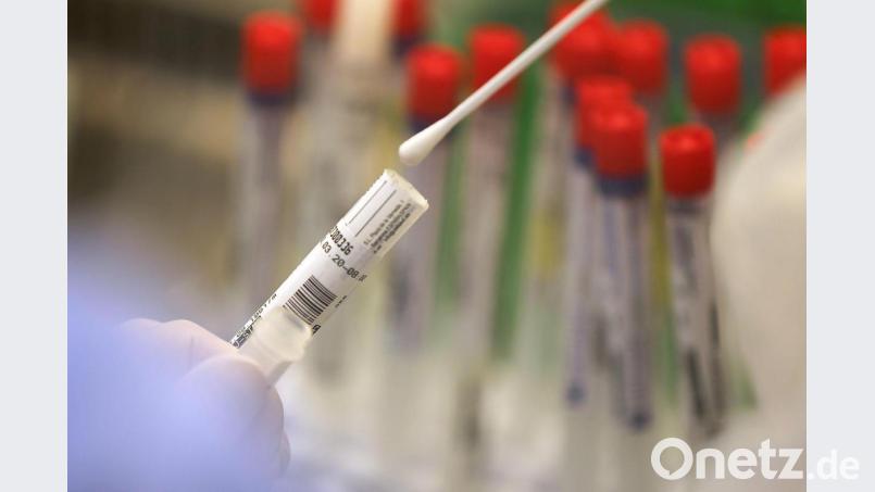Ein Abstrich wird in einem Labor auf das Coronavirus untersucht. Symbolbild: Oliver Berg