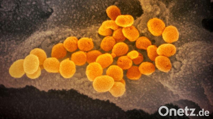 Eine elektronenmikroskopische Aufnahme des „U.S. National Institute of Health“ zeigt das Coronavirus (SARS-CoV-2). Symbolbild: NIAID-RML/AP/dpa