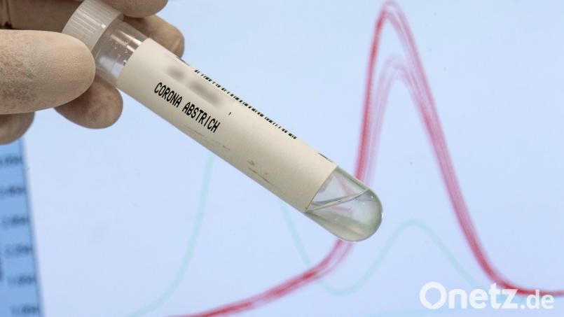 Ein Abstrichröhrchen zur Analyse des Corona-Virus wird in einem Labor vor einen Monitor gehalten Bild: Boris Roessler/dpa