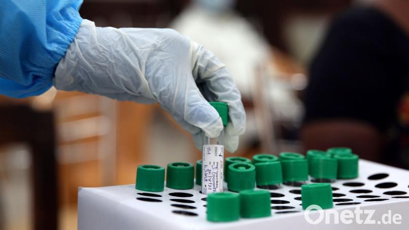 Die PCR-Test sind seit dieser Woche für den Großteil der Bevölkerung nicht mehr kostenlos. Bild: Sri Loganathan/dpa