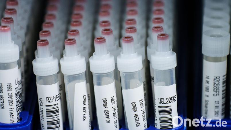 Die Zahl der neu nachgewiesenen Coronafälle in Weiden und im Landkreis Neustadt liegt wieder über 100. Intensivbetten sind daher Mangelware im Klinikenverbund Weiden und Tirschenreuth. Symbolbild: Andreas Arnold/dpa
