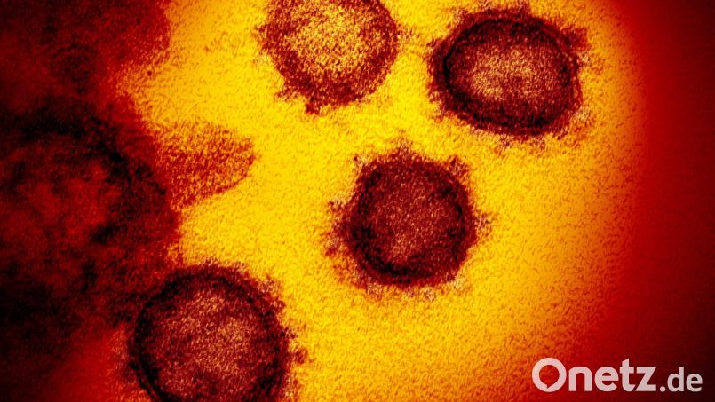 Eine elektronenmikroskopische Aufnahme des Coronavirus (SARS-CoV-2). Symbolbild: NIAID-RML/AP/dpa