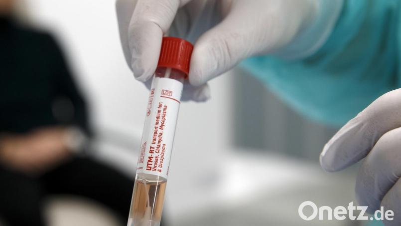 Ein Arzt zeigt die Probe einer Person, die im Verdacht steht, mit dem Coronavirus infiziert zu sein. Bild: Salvatore Di Nolfi