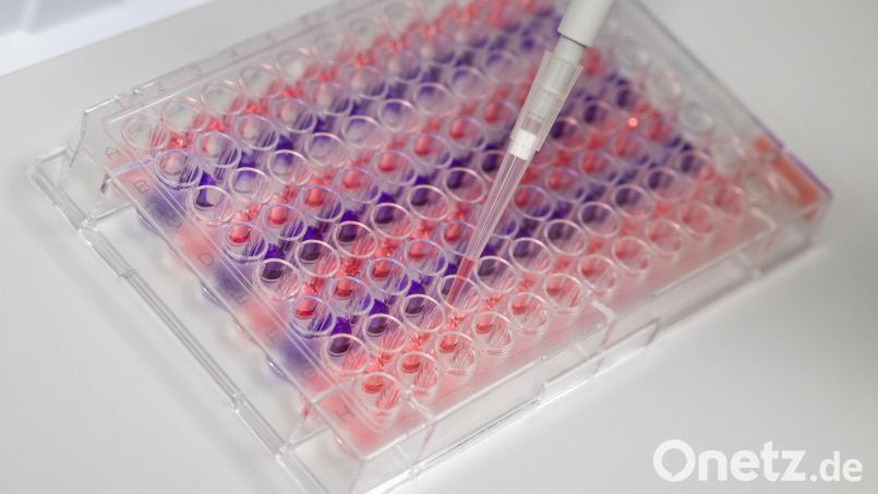 Übers Wochenende wurden im Landkreis Tirschenreuth 25 Personen positiv auf das Coronavirus getestet. Bild: Christophe Gateau/szp