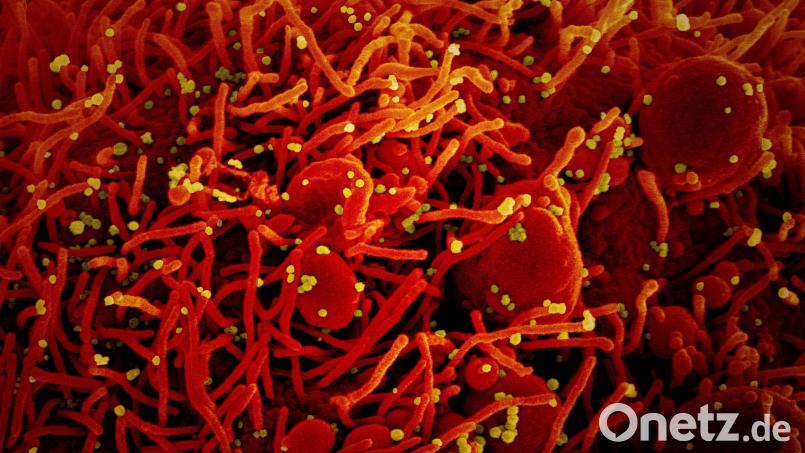 Auf dieser vom US-Forschungszentrum &quot;National Institute of Allergy and Infectious Diseases&quot; (Niaid) zur Verfügung gestellten Aufnahme ist eine Zelle (rot) mit dem Coronavirus (SARS-Cov-2, gelb) infiziert. Bild: dpa/Europa Press/Niaid