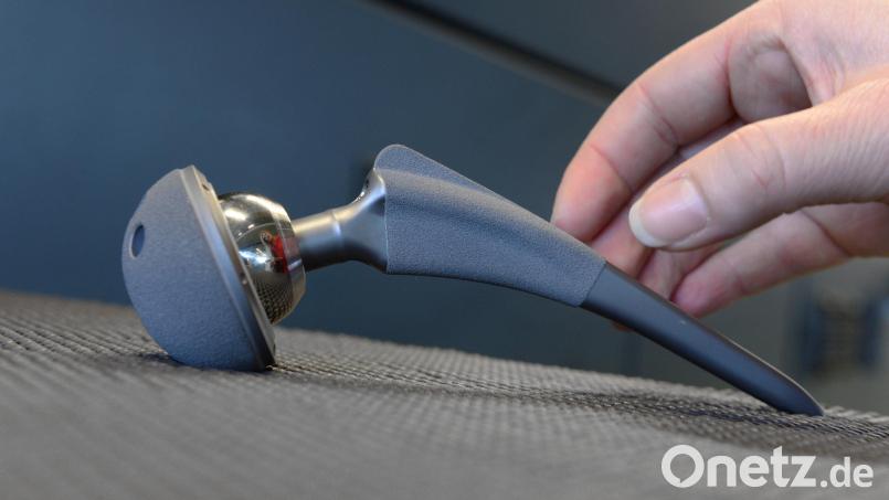 Medizinische Implantate – hier im Bild ein künstliches Hüftgelenk – sind seit vergangenem Mai auch in Lindenlohe schwerer zu bekommen. Symbolbild: Felix Kästle/exb