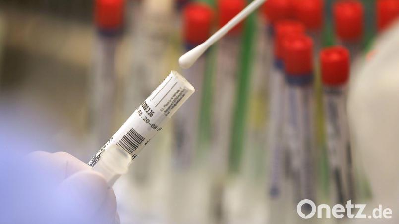 Ein Abstrich wird in einem Labor auf das Coronavirus untersucht. Symbolbild: Oliver Berg/dpa