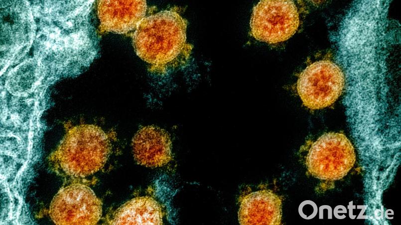 Eine elektronenmikroskopische Aufnahme zeigt Partikel des Coronavirus SARS-CoV-2.. Bild: Uncredited/NIAID/NIH/dpa