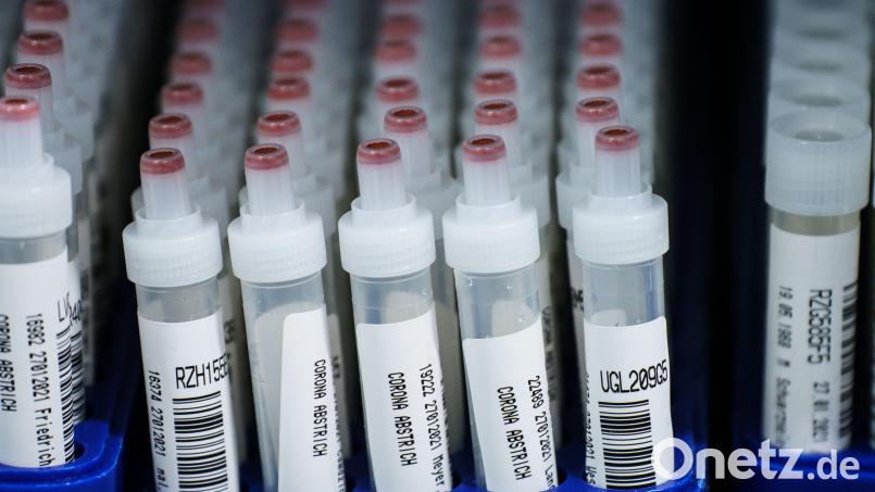 In Amberg und Amberg-Sulzbach gab es über das Wochenende zwei neue Todesfälle infolge einer Coronainfektion. Symbolbild: Andreas Arnold/dpa