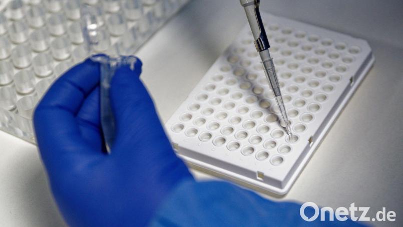 Der Omikron-Subtyp BA.2 scheint sich nach neuen Erkenntnissen in bestimmten Eigenschaften deutlich von der in Deutschland bislang dominanten Corona-Subvariante BA.1 zu unterscheiden. Bild: Henning Kaiser/dpa