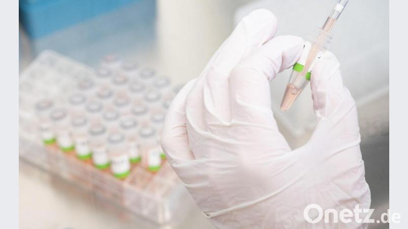 Entspannung in den Laboren: Es werden weitaus weniger PCR-Tests nachgefragt, als in den ersten Wochen des Jahres. Bild: Julian Stratenschulte/dpa