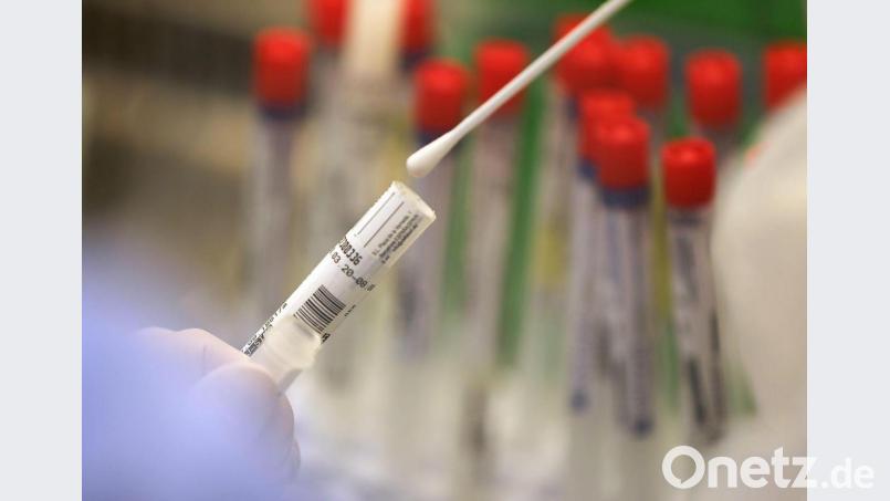 Ein Abstrich wird in einem Labor auf das Coronavirus untersucht. Bild: Oliver Berg/dpa/Symbolbild