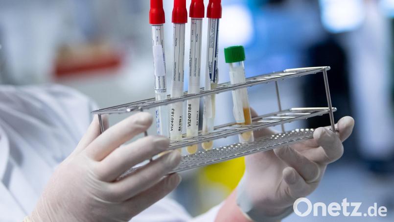 Eine Laborantin bereitet Proben für Corona-Tests für die weitere Analyse vor. Symbolbild: Sven Hoppe/dpa