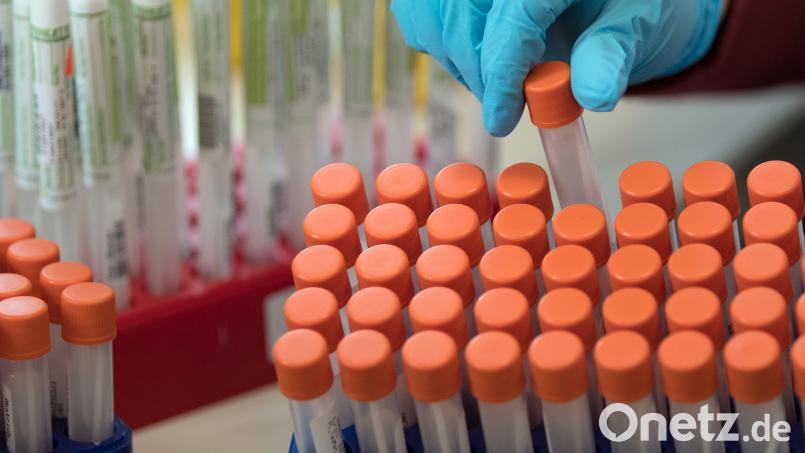 Proben für Corona-Tests werden im Labor für die weitere Untersuchung vorbereitet. Bild: Hendrik Schmidt