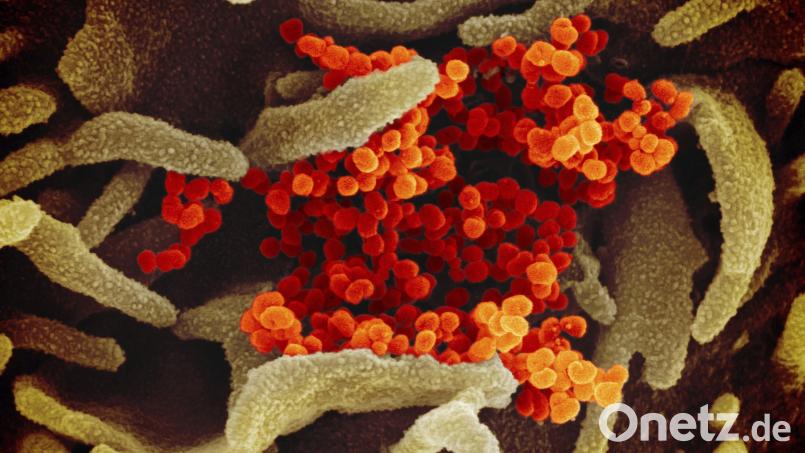 Diese elektronenmikroskopische Aufnahme zeigt das Coronavirus (orange), das aus der Oberfläche von im Labor kultivierten Zellen (grau) austritt. In Amberg und Amberg-Sulzbach halten sich die Meldungen von positiv Getesteten momentan in Grenzen. Symbolbild: NIAID-RML/dpa