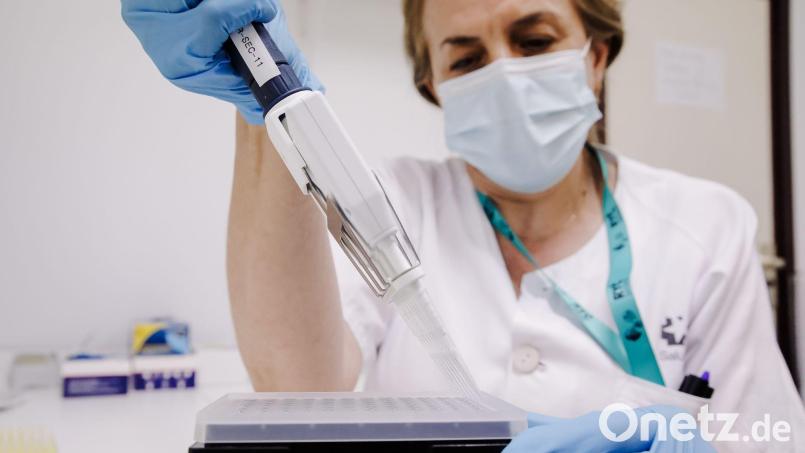 Eine Krankenschwester bereitet in einem Krankenhaus einen PCR-Tests zur Erkennung des Affenpockenvirus vor. Bild: Carlos Luján/EUROPA PRESS/dpa/Bildarchiv