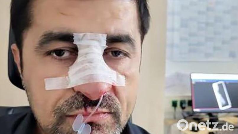 Das vom Landtagsabgeordneten Arif Tasdelen, Bruder von Halil Tasdelen, zur Verfügung gestellte Bild zeigt den verletzten Halil Tasdelen. Bild: Arif Tasdelen/dpa