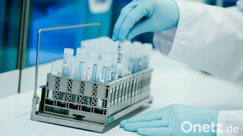 Ein Mitarbeiter bereitet in einem Heidelberger Coronatest-Labor PCR-Teströhrchen vor. Bild: Uwe Anspach/dpa