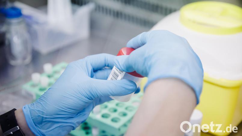 Eine Krankenschwester untersucht einen PCR-Test. Der erste Fall von Affenpocken in der Oberpfalz ist bekannt und erwiesen. Symbolbild: Carlos Luján/dpa