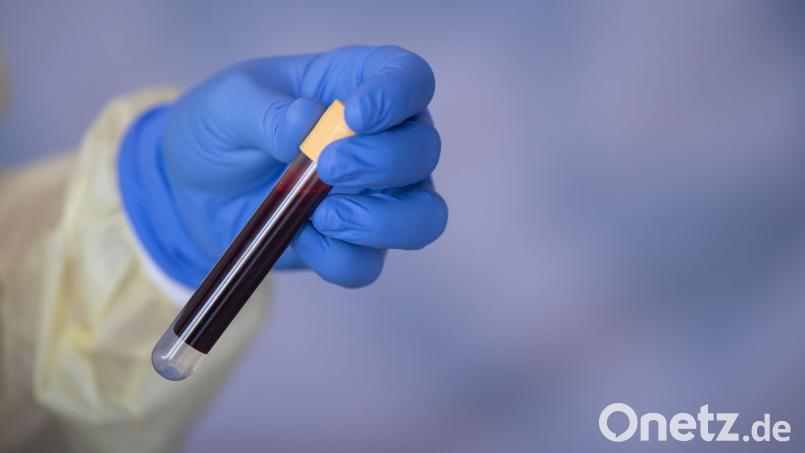 Wegen einer Trunkenheitsfahrt brachte die Polizei einen 56-Jährigen ins Krankenhaus zur Blutentnahme. Kurze Zeit später wollte der Mann die Blutprobe im Auto stehlen. Symbolbild: Marijan Murat/dpa