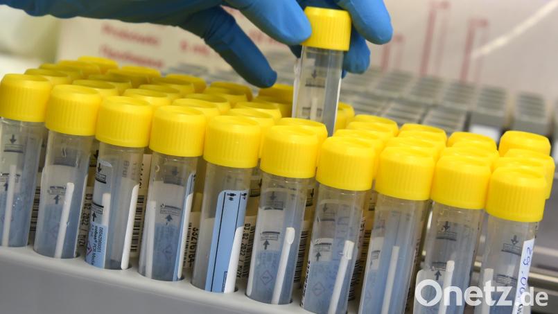 Die Zukunft der Labormedizin in Weiden, Tirschenreuth und Kemnath ist zurzeit heftig umstritten. Doch auch die hohen Energiekosten bereiten der Kliniken Nordoberpfalz AG derzeit enorme Probleme. Symbolbild: Waltraud Grubitzsch