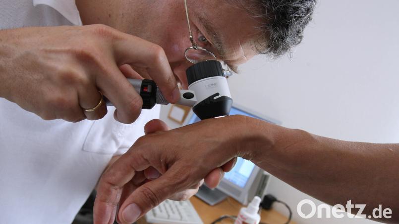 Ein Muttermal? Oder doch schlimmer? Oft kann nur ein Mediziner diese Fragen beantworten. Doch viele Oberpfälzer Männer scheuen noch immer davor zurück, den Arzt zu konsultieren. Symbolbild: Karl-Josef Hildenbrand