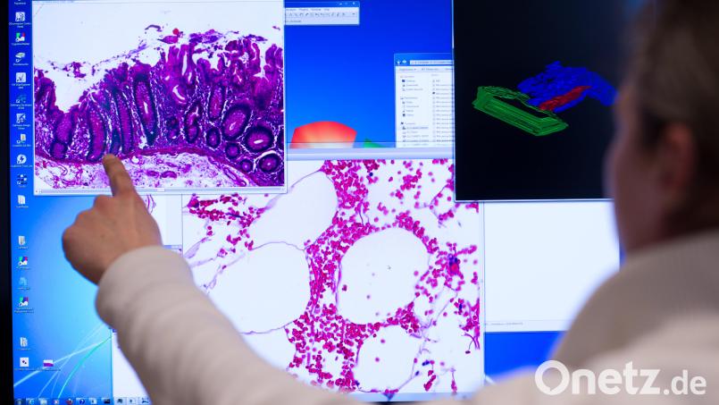 Laut dem Bundesverband Deutscher Nuklearmediziner werden Radionuklide unter anderem bei der detaillierten Diagnostik vieler Krebsarten eingesetzt. Symbolbild: Bernd von Jutrczenka/dpa