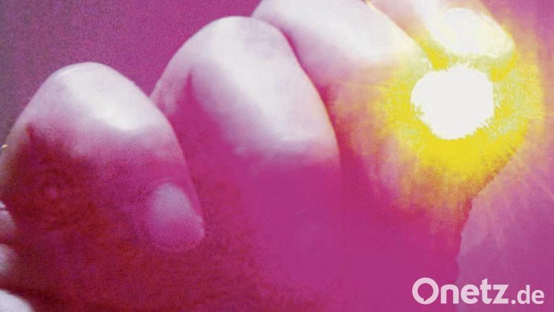 Laserpointer können großen Schaden anrichten. Symbolbild: Patrick Lux/dpa