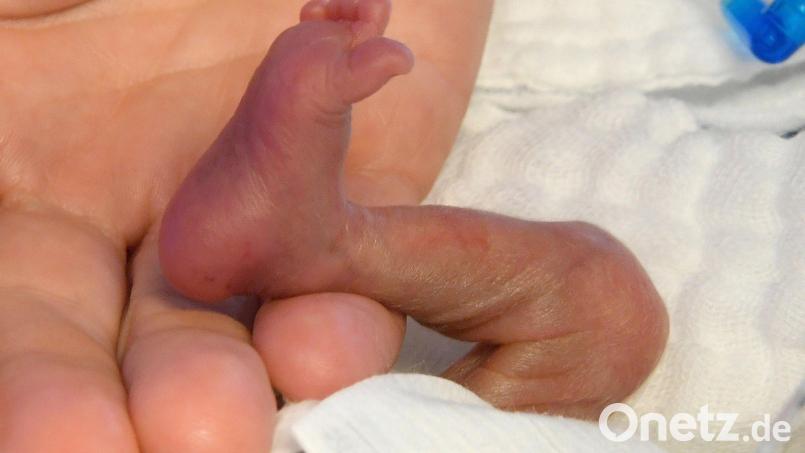 Auf der Station 90f der Kinderklinik werden die Frühgeborenen versorgt. Bild: Holger Hollemann/dpa