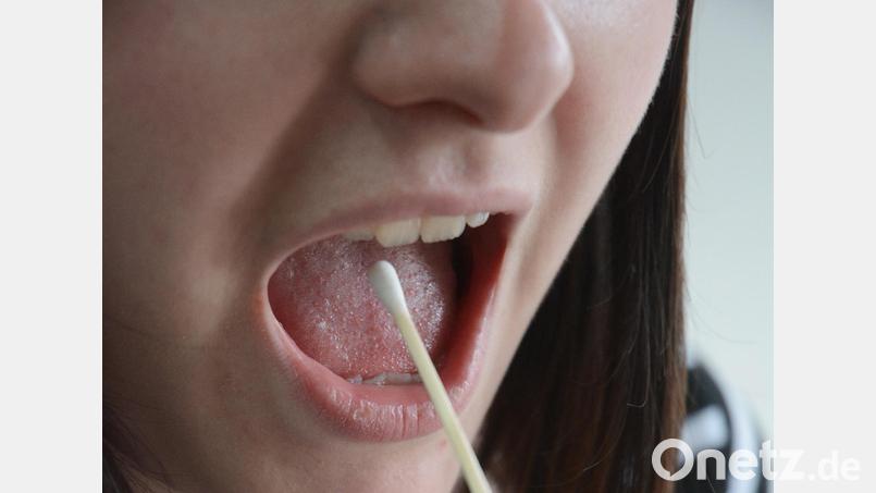 Mit einem Wangenabstrich kann man sich für die Knochenmarkspender-Datei registrieren lassen. Archivbild: Gabi Schönberger