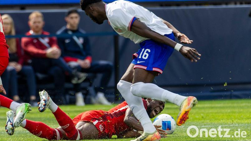 Alphonso Davies (unten) verletzte sich im Länderspiel gegen die USA. Bild: Ringo Chiu/ZUMA Press Wire/dpa