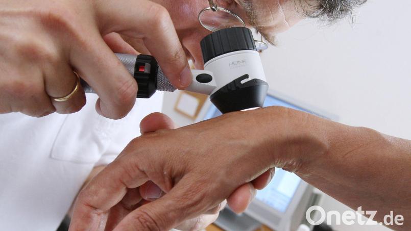 Die Zahl der Hauterkrankungen bis hin zum Hautkrebs nimmt zu. Die Zahl der Dermatologen, die sich auf offene Facharztstellen bewirbt, ist jedoch überschaubar. Auch im Landkreis Tirschenreuth sind 1,5 Kassensitze offen. Symbolbild: Karl-Josef Hildenbrand/dpa