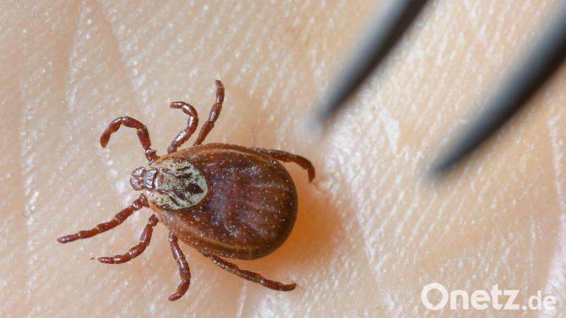 Zecken kann man sich zum Beispiel beim Spazierengehen im Wald holen. (Archivbild) Bild: Patrick Pleul/dpa-Zentralbild/dpa