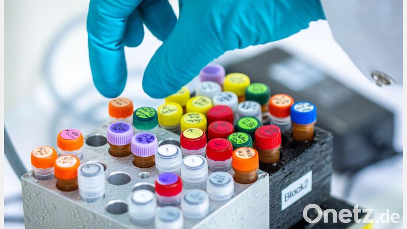 Ehec bezeichnet bestimmte krankmachende Stämme des Darm-Bakteriums, die vor allem bei Wiederkäuern wie Rindern vorkommen (Archivbild). Bild: Jens Büttner/dpa