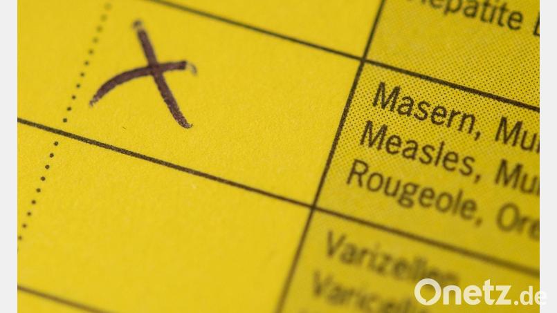 In einem Schnellrestaurant im Landkreis Erding gibt es einen Masernfall. (Archivbild) Bild: Marius Becker/dpa