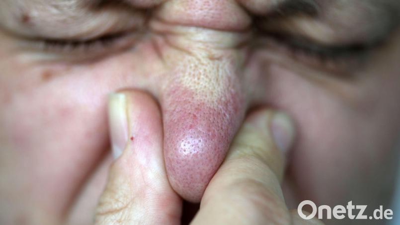 Am Untermain kommen Experten dem zeitweiligen Gestank bisher nicht auf die Spur. (Symbolbild) Bild: Oliver Berg/dpa