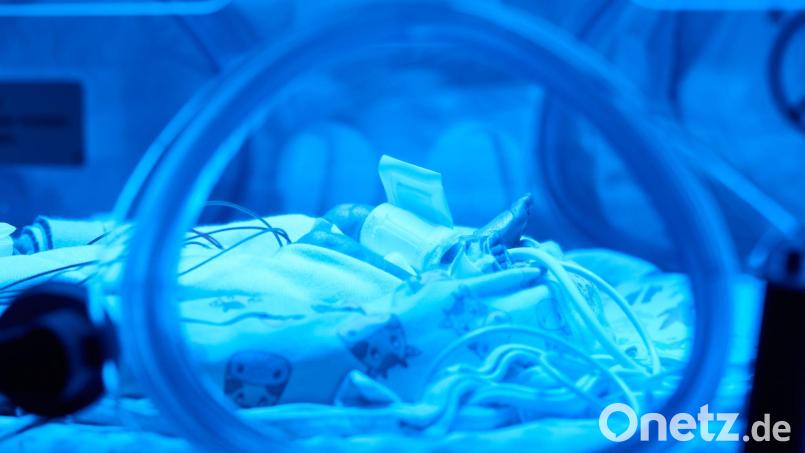 Zwei Jahre wird das Projekt in Nürnberg getestet, dann könnte die KI bayernweit eingesetzt werden. (Symbolbild) Bild: Bernd Thissen/dpa