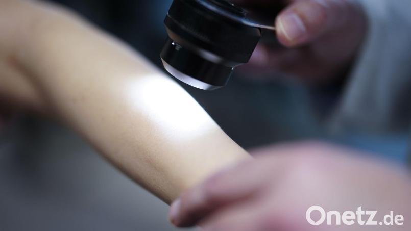 Nicht nur Hautkrebs lässt sich bei entsprechenden Vorsorgeuntersuchungen frühzeitig erkennen - und dann oft gut behandeln. (Symbolbild) Bild: Eva Manhart/apa/dpa