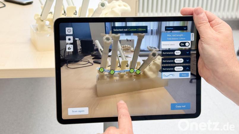 Eine spezielle Software auf einem Tablet berechnet während der Operation die notwendige Krümmung, die der implantierte Titanstab haben muss. Professor Dr. Thomas Reithmeier (Klinikum Weiden) passt das Implantat für den Patienten individuell an. Bild: Gabi Schönberger