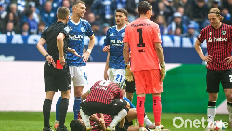 Nachdem er den Hannoveraner Husseyn Chakroun mit dem hohen Fuß getroffen hatte, wurde Edin Dzeko des Feldes verwiesen. Bild: Bernd Thissen/dpa