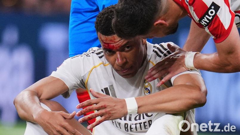 Kylian Mbappé wurde im Spiel gegen Girona im Gesicht verletzt. Archivbild: Manu Fernandez/AP/dpa