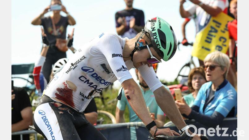 Paul Seixas kämpfte sich mit Blut und Löchern auf dem Trikot zurück ans Feld. Bild: Anne-Christine Poujoulat/AFP/dpa
