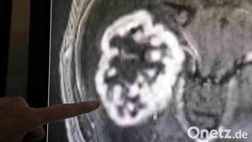 Laut WHO werden 92 Prozent aller Menschen zumindest einmal im Leben mit dem Thema Krebs konfrontiert - als Betroffener oder Angehöriger Bild: Bernd Wüstneck/dpa-Zentralbild/dpa