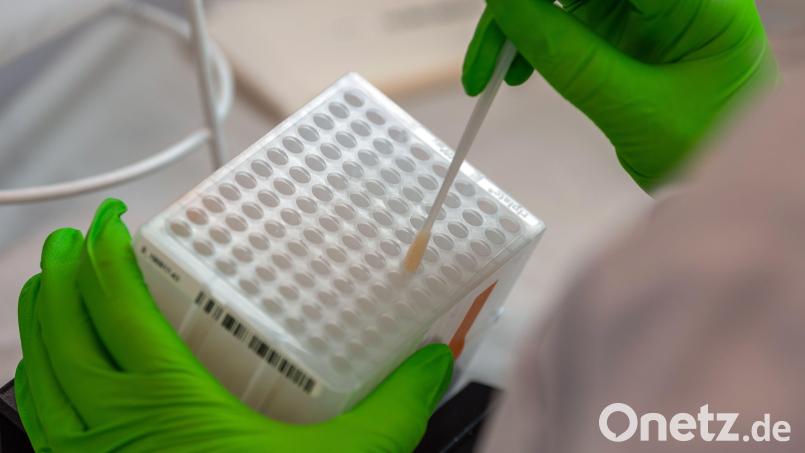 Für den Typisierungsprozess der DNA werden Zellen der Wangenschleimhaut entnommen. Hier werden die medizinischen Wattestäbchen für weitere Analysen einsortiert. Archivbild: Robert Michael/dpa