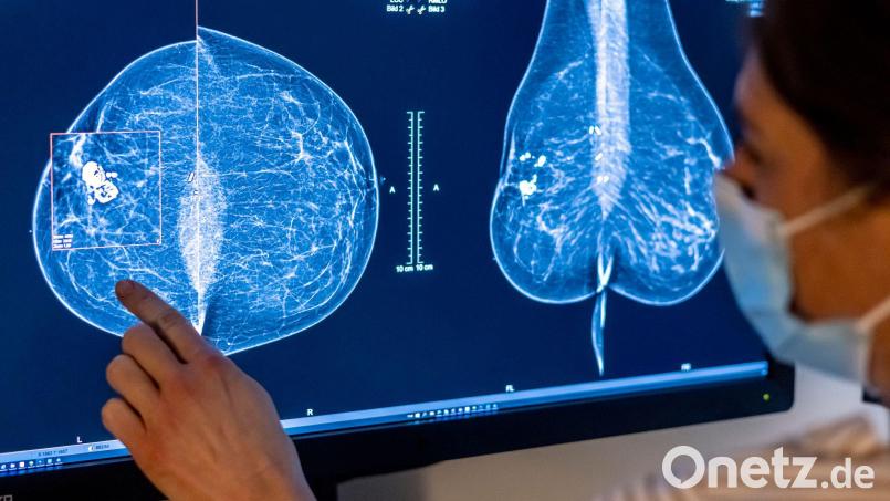 Nach Angaben der Charité leben rund 68.000 Frauen in Deutschland mit Brustkrebs, der Metastasen gebildet hat (Archivbild). Bild: Hannibal Hanschke/dpa