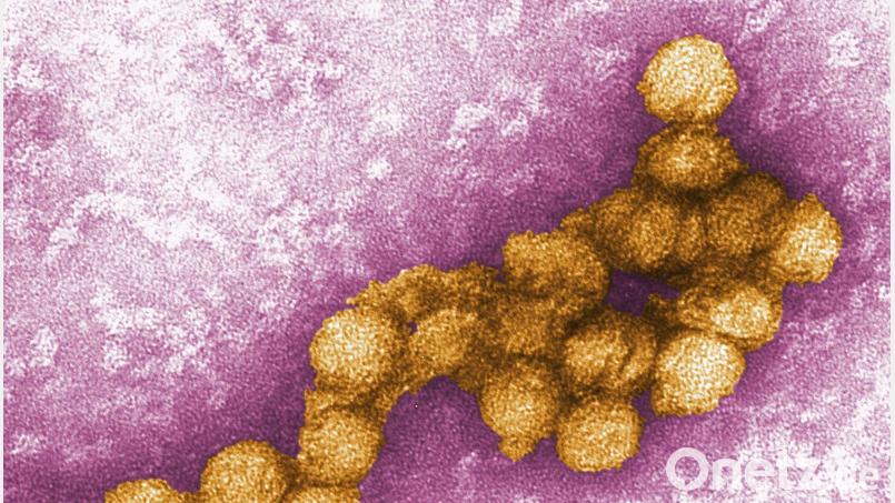 So sieht das West-Nil-Virus unter dem Elektronenmikroskop aus. (Archivbild) Bild: Cynthia Goldsmith/CENTERS FOR DISEASE CONTROL/EPA/dpa