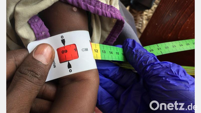 Schon jetzt gelten fast zwei Millionen Kinder in Somalia akut unterernährt. (Archivbild) Bild: Eva-Maria Krafczyk/dpa