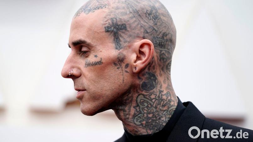 Travis Barker geht davon aus, dass er in ein paar Wochen wieder fit ist. (Archivbild) Bild: Jae C. Hong/Invision/AP/dpa