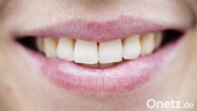 Nach Angaben der Polizei ermittelt die Polizeiinspektion Amberg nach einer misslungenen Lippenbehandlung in Nürnberg wegen des Verdachts der Körperverletzung. Symbolbild: Victoria Bonn-Meuser