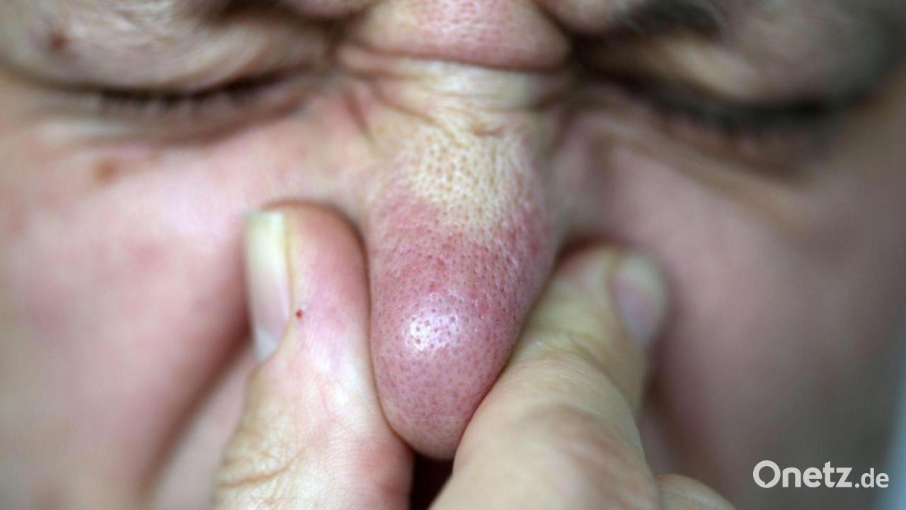 Ursache für Gestank am Untermain gefunden